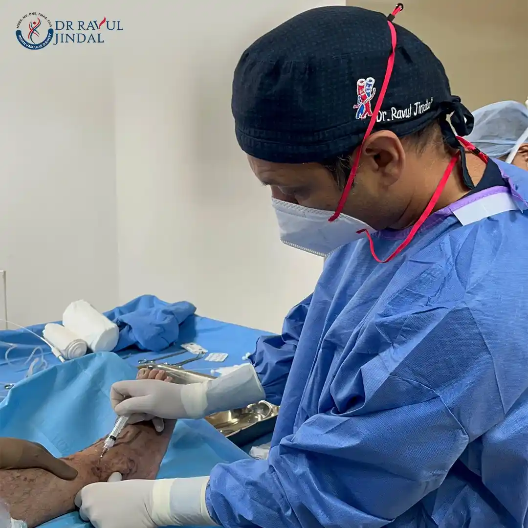 Minimally invasive varicose veins surgery