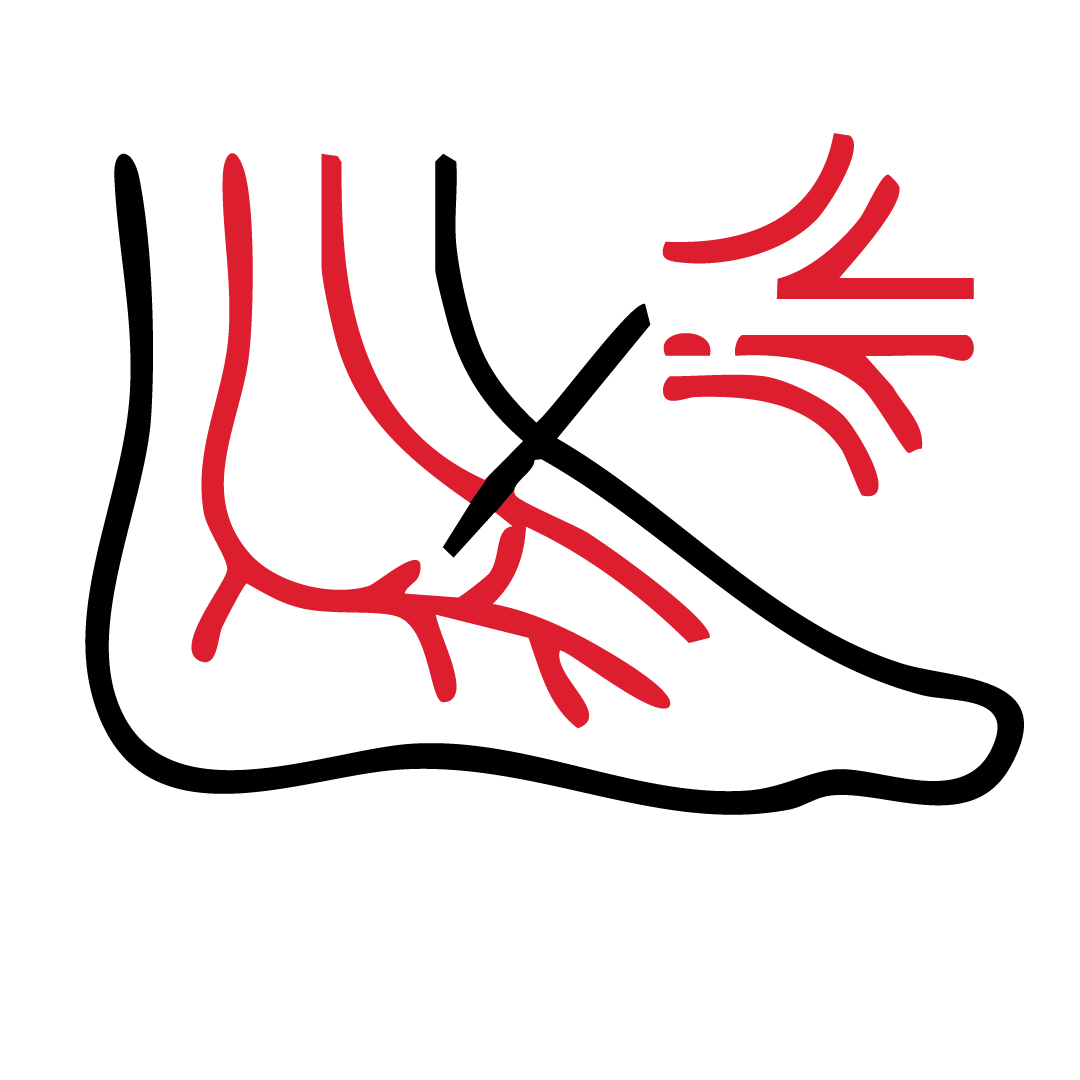 DIABETIC FOOT