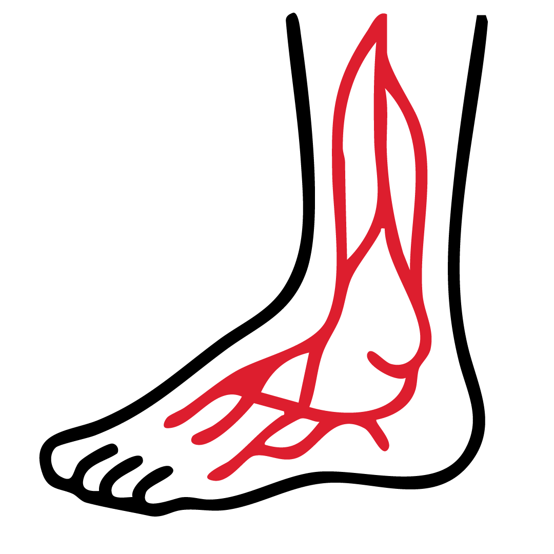DVT MANAGEMENT
