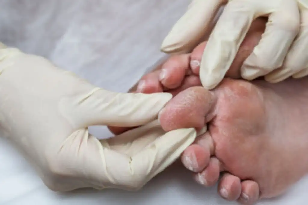 What is Limb Salvage Surgery ?
