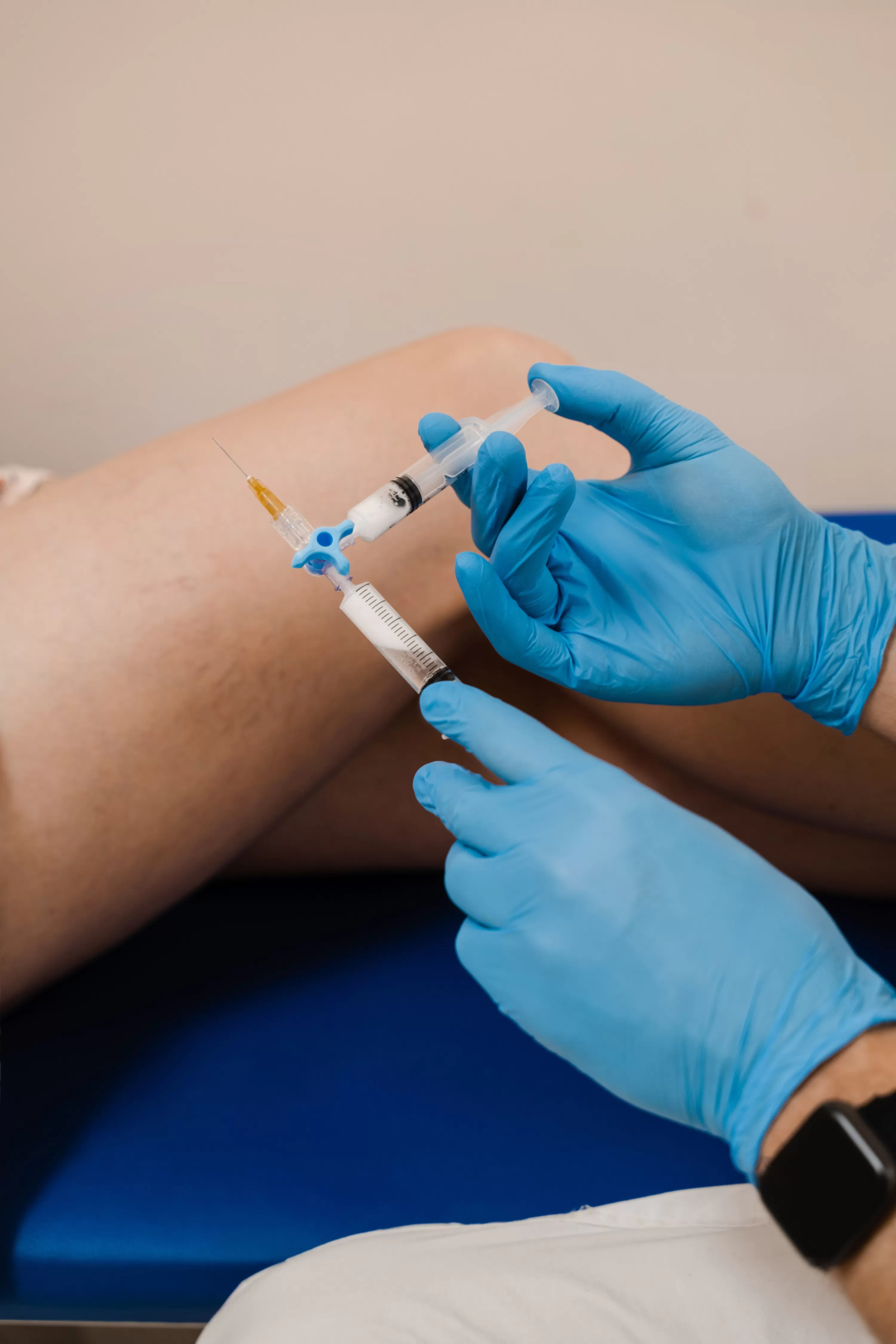 Foam Sclerotherapy
